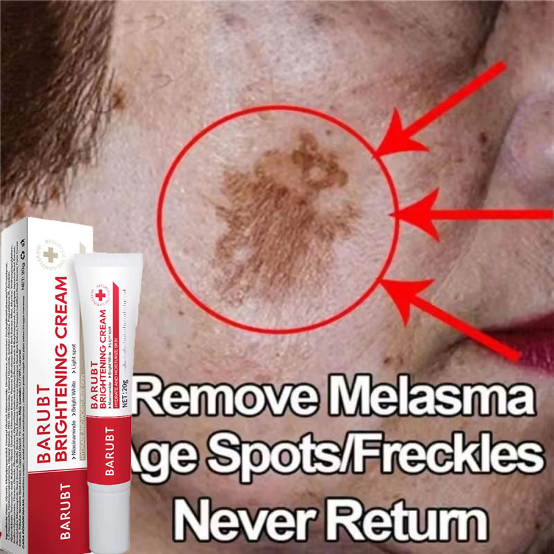 Photography Treatment - Powerful Spot-removing Whitening Cream Brighten Skin