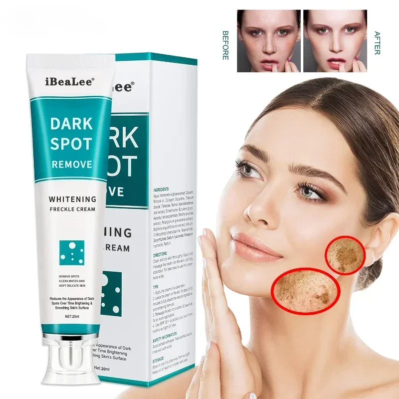 Photography Treatment - Whitening Freckle Cream Remove Dark Spots