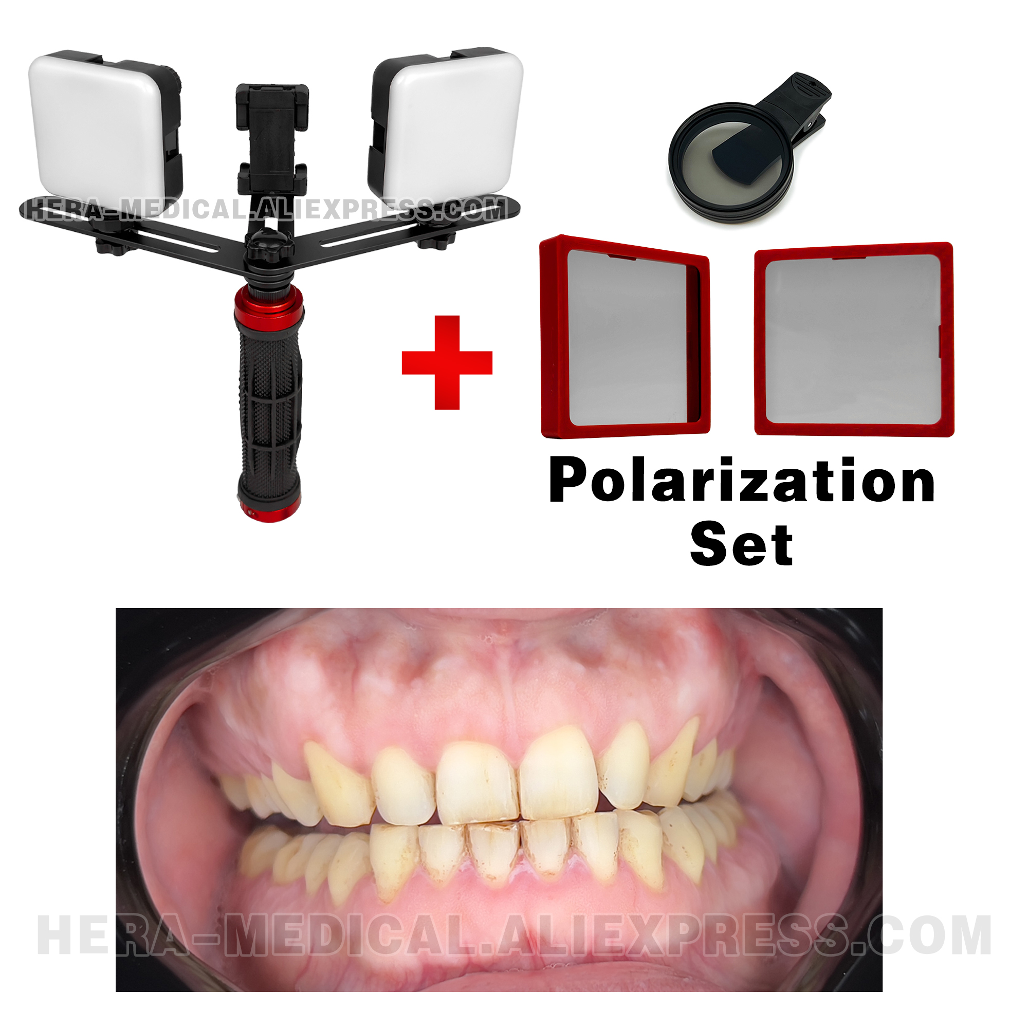 Dental Photography LED Light B - Photography Treatment avis et prix