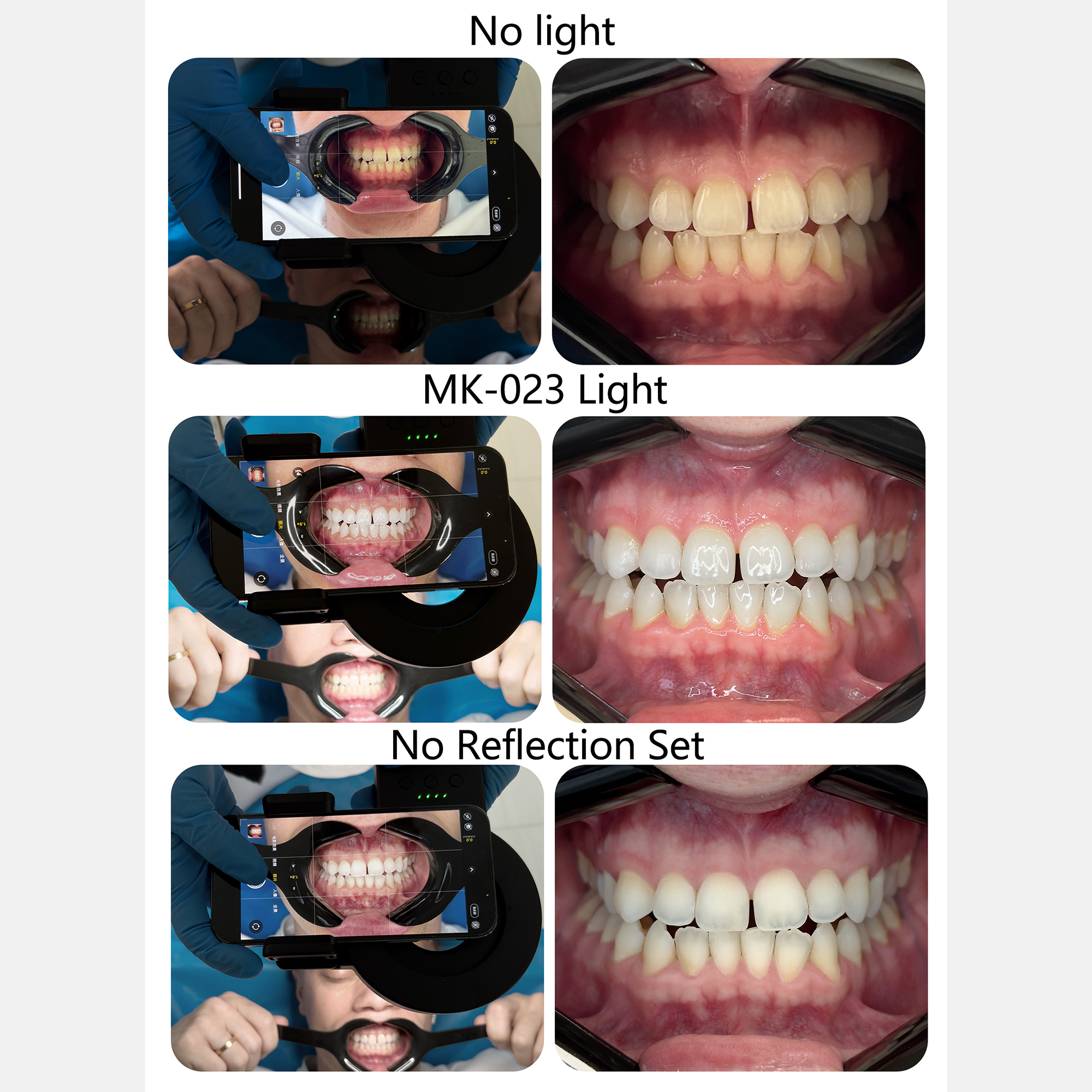 HERA MK-23 Intraoral Dental Ph - Photography Treatment avis et prix