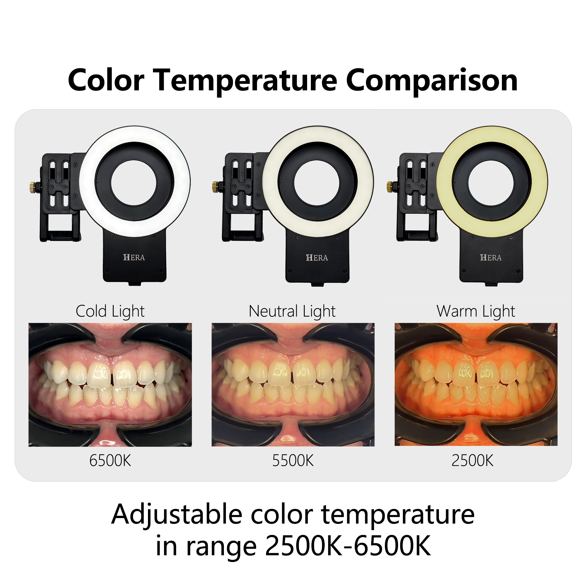 HERA MK-23 Intraoral Dental Ph - Photography Treatment avis et prix