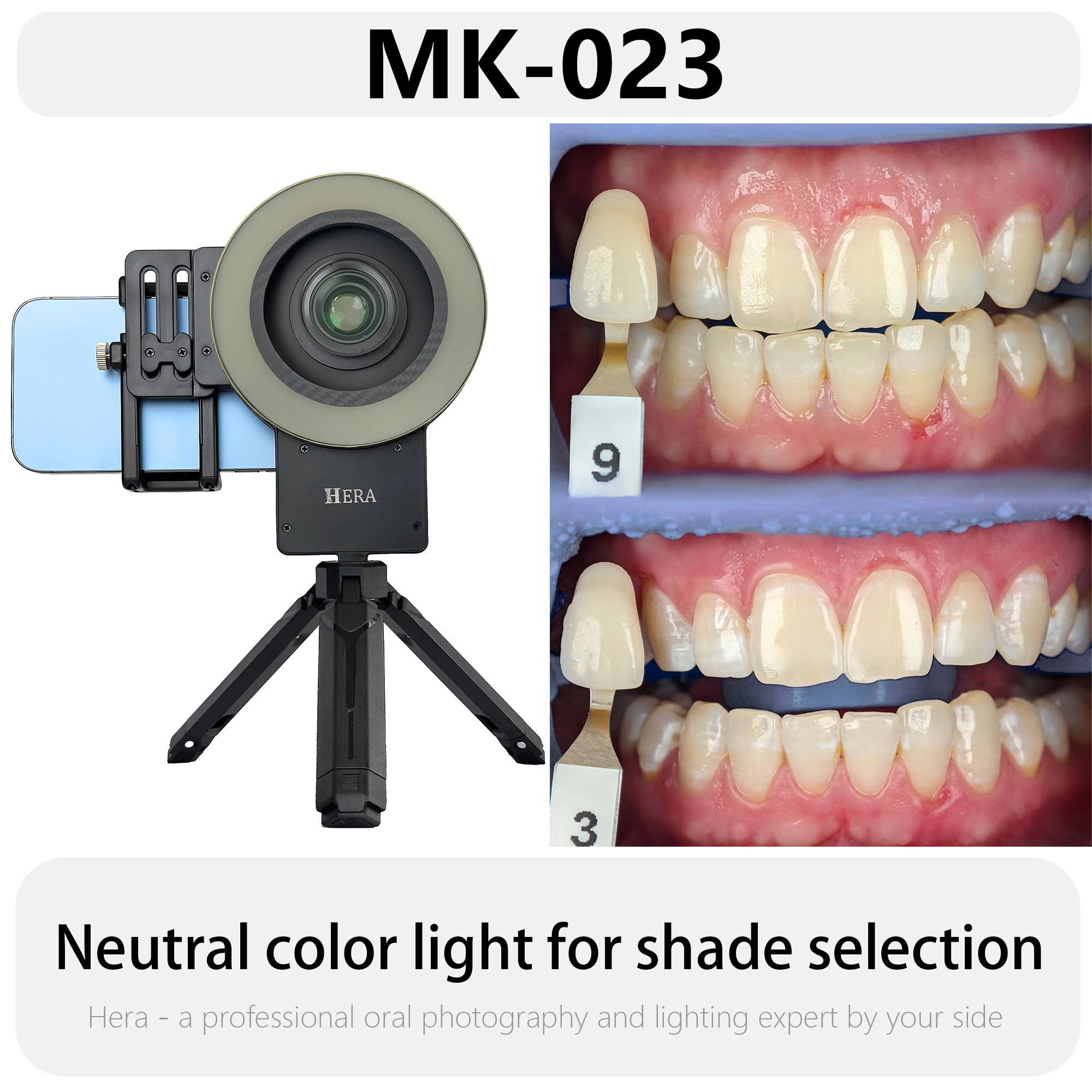 HERA MK-23 Intraoral Dental Ph - Photography Treatment avis et prix