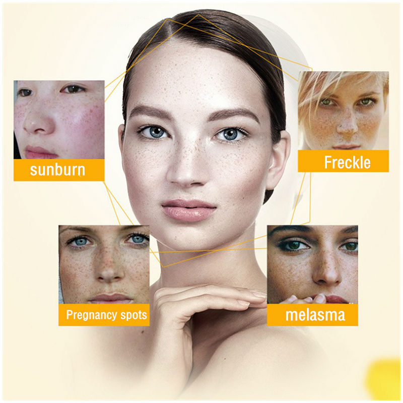Dimollaure Whitening Freckle C - Photography Treatment avis et prix