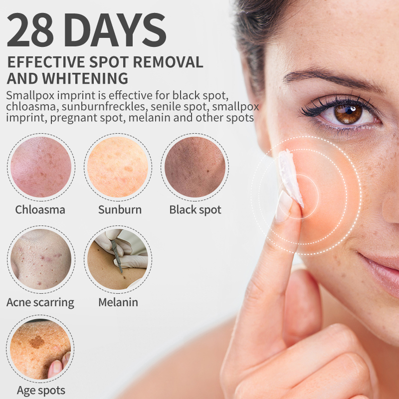 Dimollaure Whitening Freckle C - Photography Treatment avis et prix