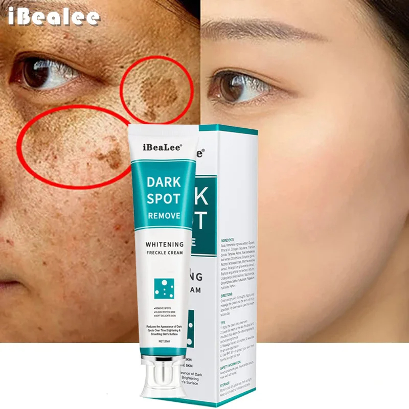 Whitening Freckle Cream Remove - Photography Treatment avis et prix