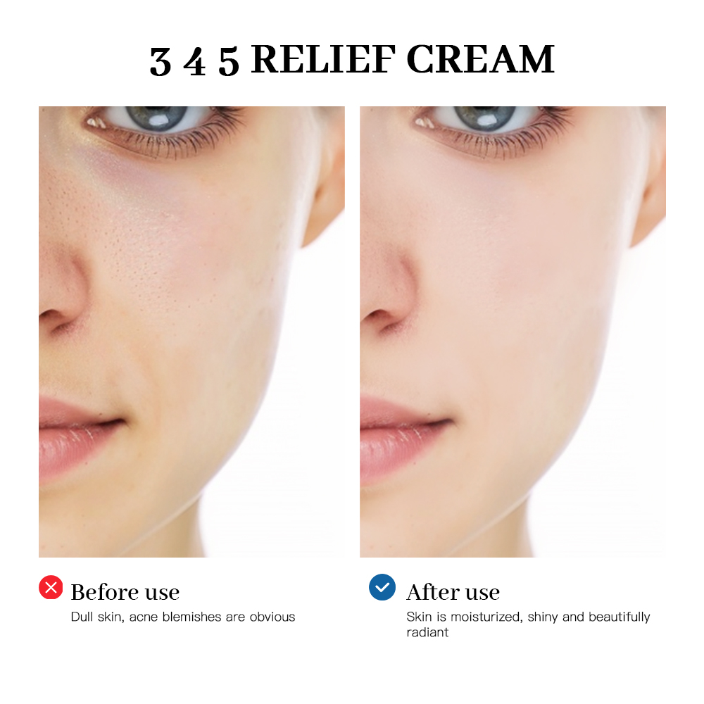 345 Relief Cream Address Blemi - Photography Treatment avis et prix